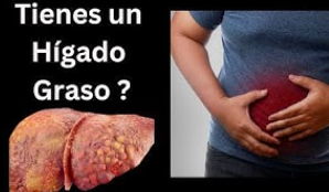 Las transaminasas hepáticas y su importancia en la salud hepática